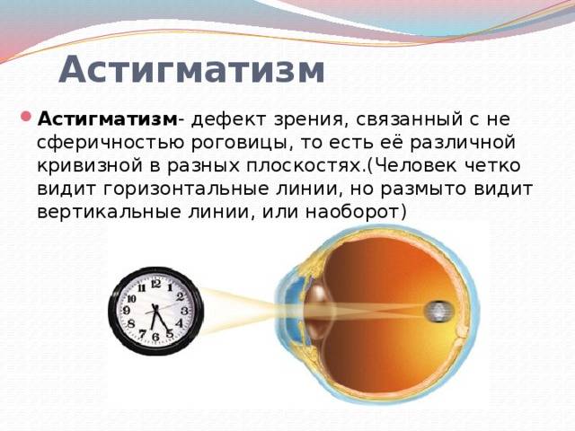 Нарушения периферического зрения, глазные болезни - офтальмологический портал vseozrenii.