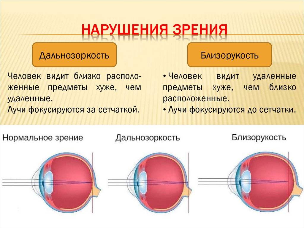 Симптомы болезни - нарушения зрения