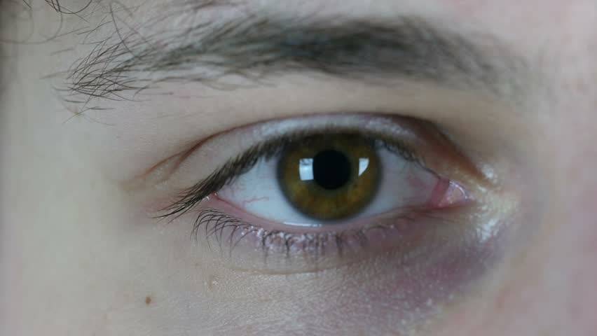 Частое моргание глазами у взрослых лечение - лечим сами