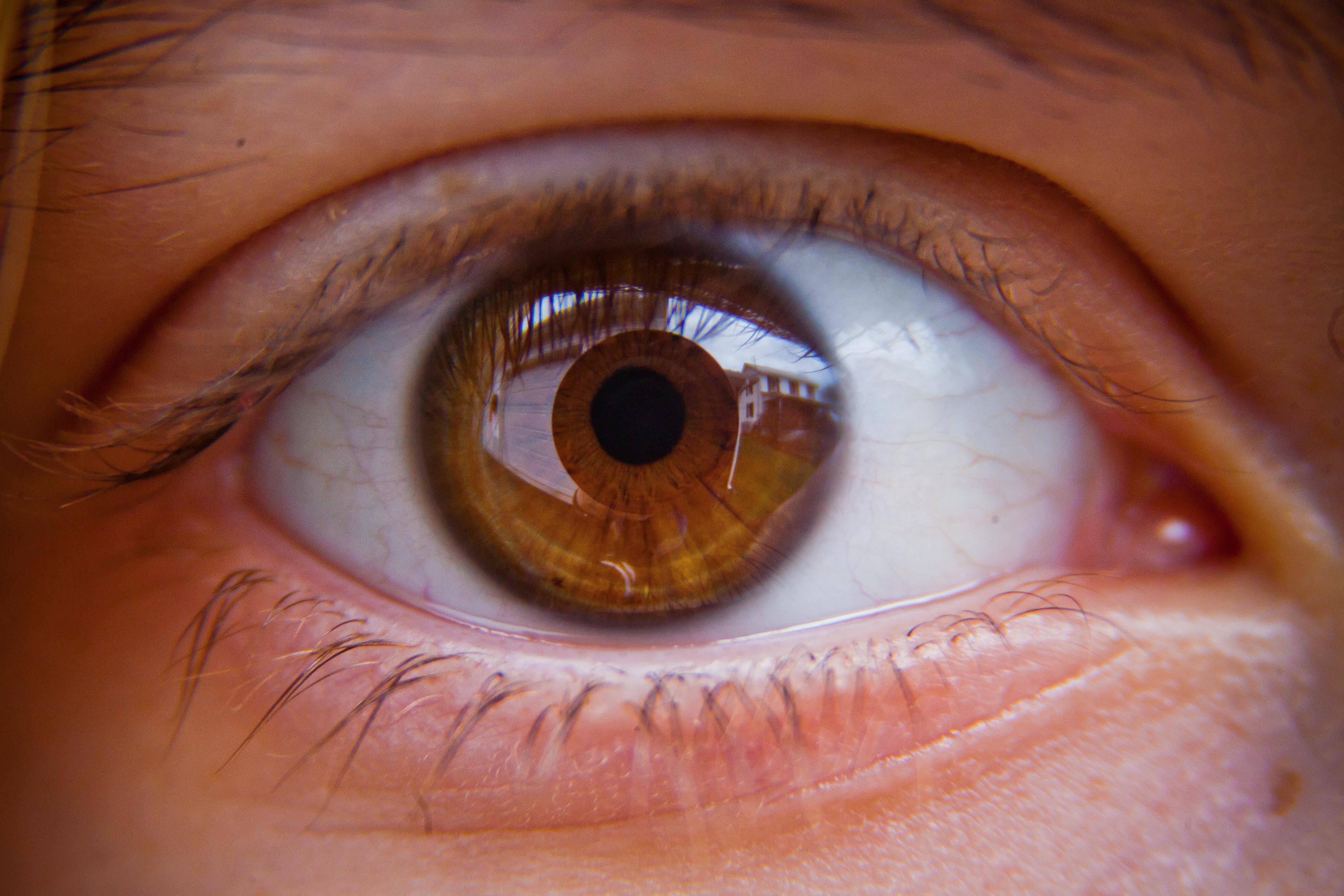 Болят глаза от линз: основные причины боли, что делать