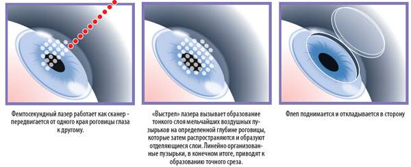 Фемтосекундный лазер , плавно изменяющий длину волны в офтальмологии челябинск катаракта visumax отзывы цена купить