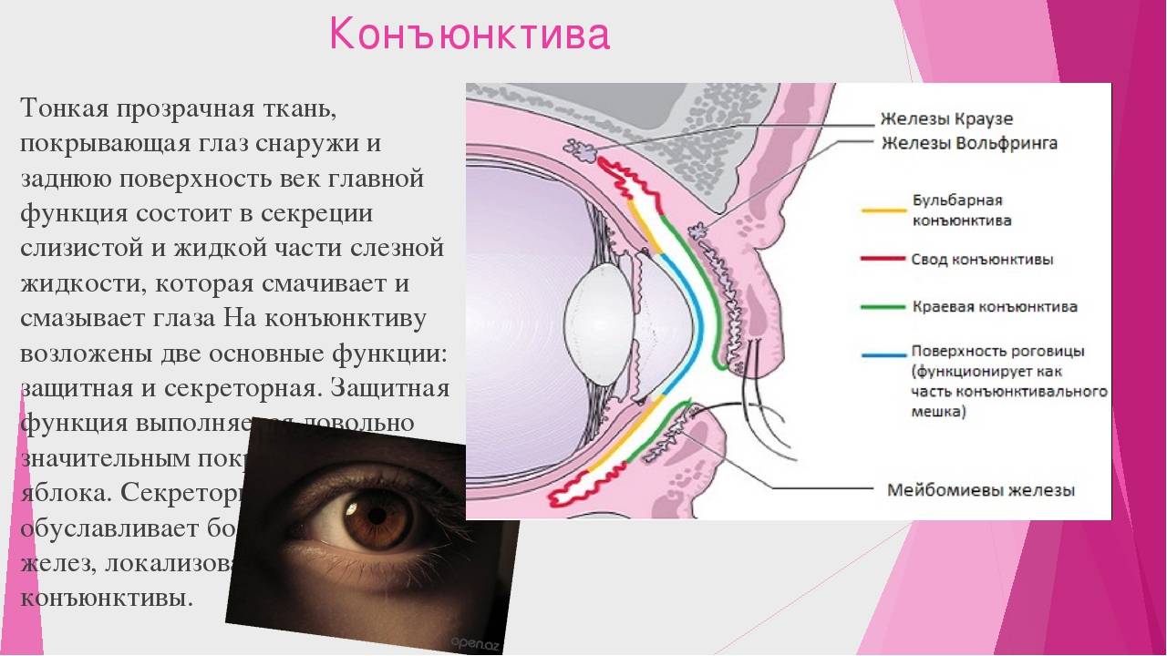 Хемоз конъюнктивы: симптомы и способы лечения - "здоровое око"