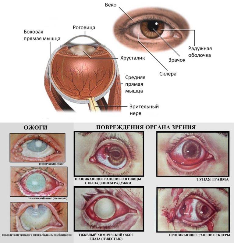 Царапина на роговице глаза, первая помощь и лечение - "здоровое око"
