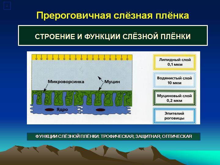 Синдром сухого глаза