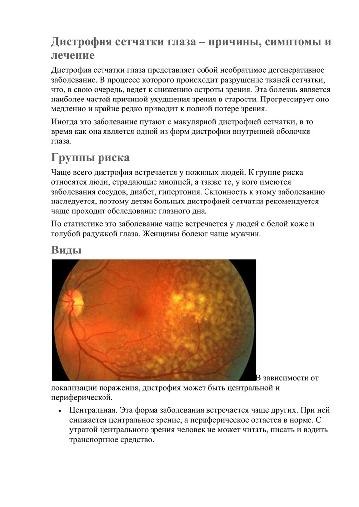 Симптомы и лечение расслоения сетчатки глаза: что такое редкая болезнь ретиношизис?
