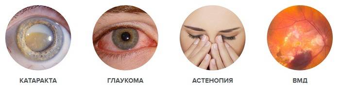 Признаки глаукомы глаза - симптомы и признаки глаукомы в ранней стадии у взрослых | медицинский портал spacehealth