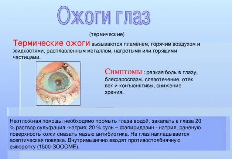 Ожог глаз кварцевой лампой лечение последствия
