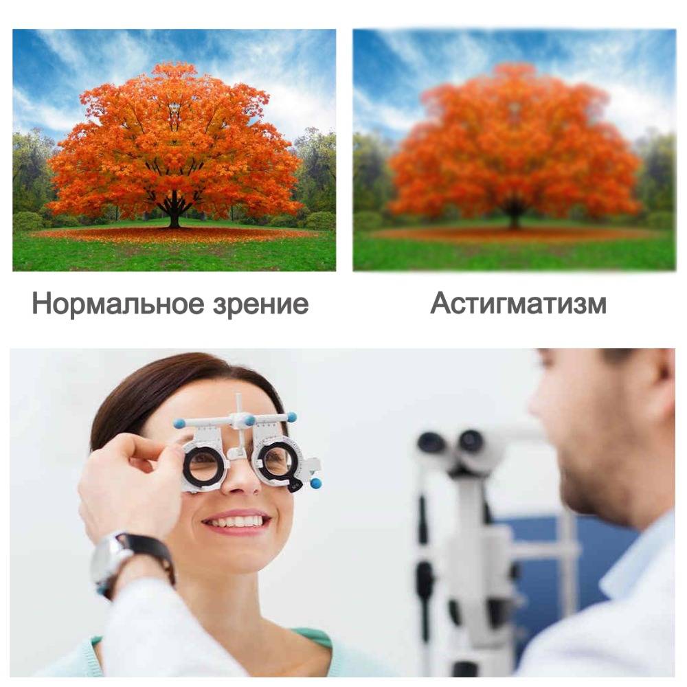 Cложный астигматизм: причины, виды, симптомы и лечение - глаза эксперт.