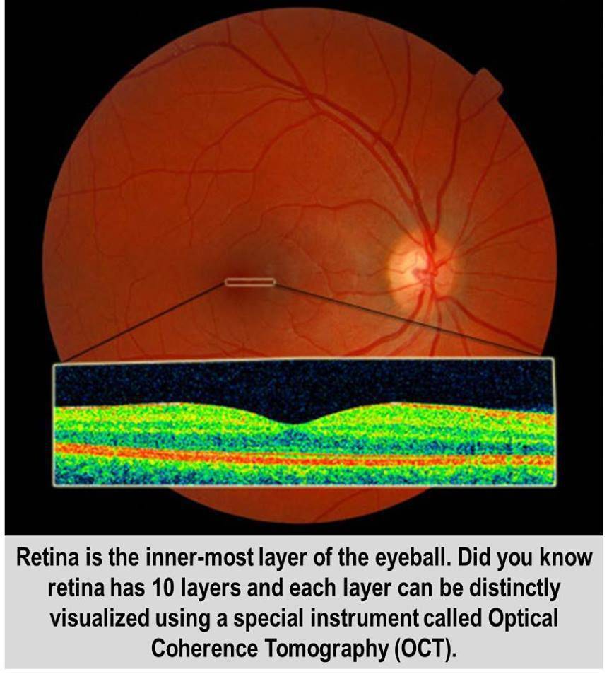 Компьютерная томография сетчатки глаза: что это, когда назначают, расшифровка результатов