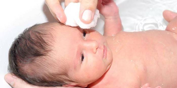 Чем промыть глаза новорожденному ребенку при закисании, гноении, конъюнктивите (видео)