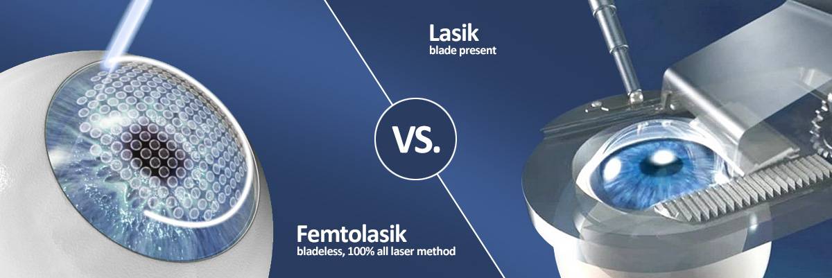 Сравнение методов коррекции зрения: ласик или фемтоласик, что лучше?
