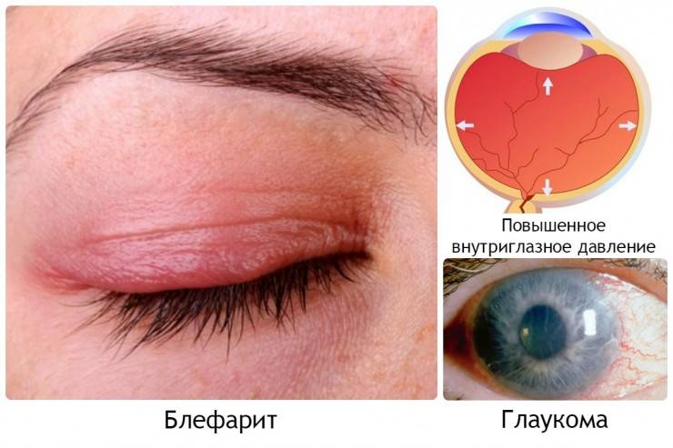 Резкая боль в глазу: причины колющей боли oculistic.ru
резкая боль в глазу: причины колющей боли
