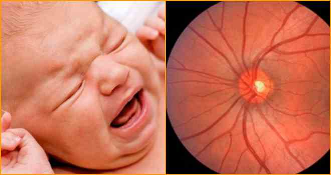 Ангиопатия сетчатки глаза у ребенка: причины, симптомы и лечение. детский офтальмолог