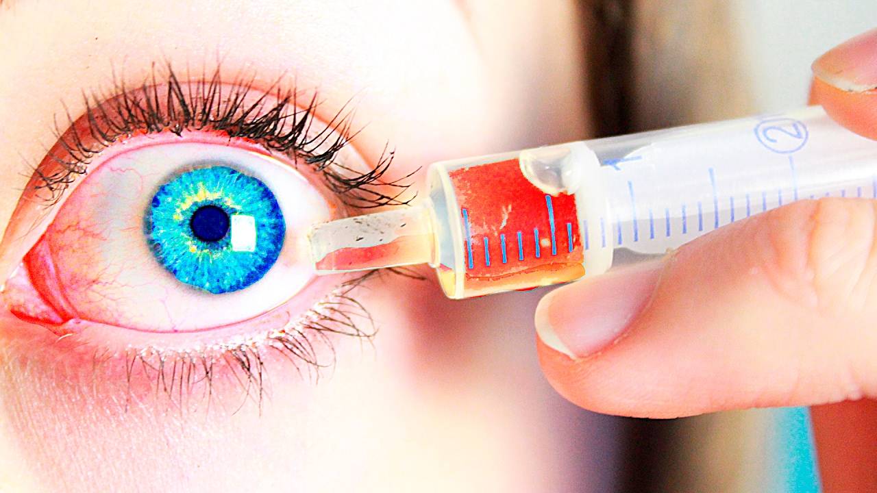 Как делают укол в глаз и какие препараты используют oculistic.ru
как делают укол в глаз и какие препараты используют