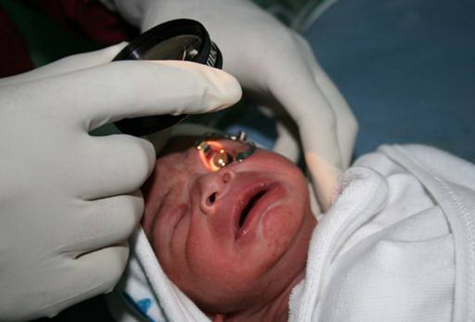Новорождённый закатывает глаза возможные причины