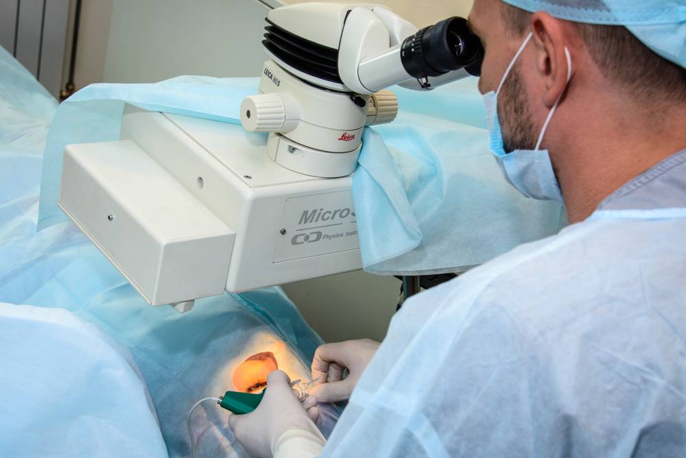 Вторичная катаракта после замены хрусталика: лечение и отзывы