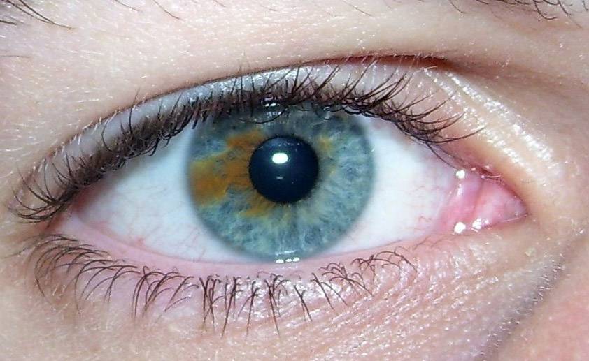 Белки глаз желтые: причины и как лечить, профилактика
