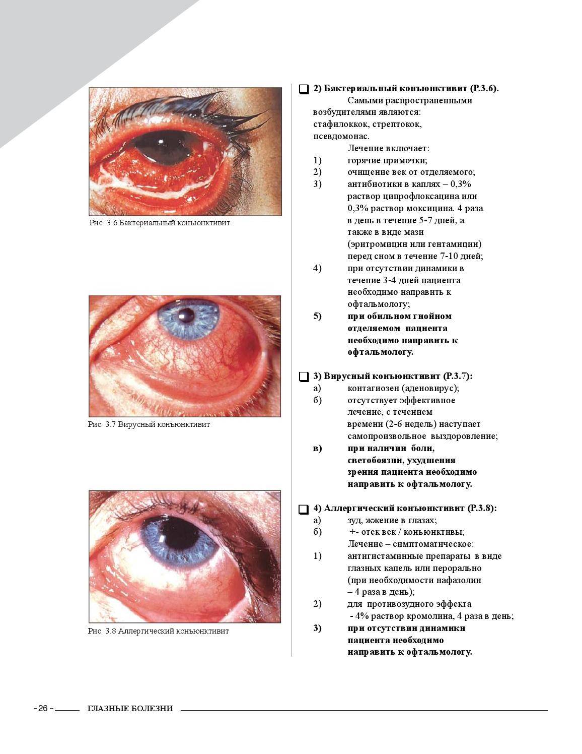 Болезни глаз у человека: список, фото, симптомы и лечение