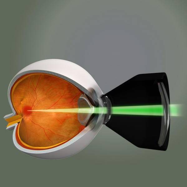 Какие операции на сетчатке глаза делают при ее отслоении или разрыве, и когда происходит восстановление зрения?
