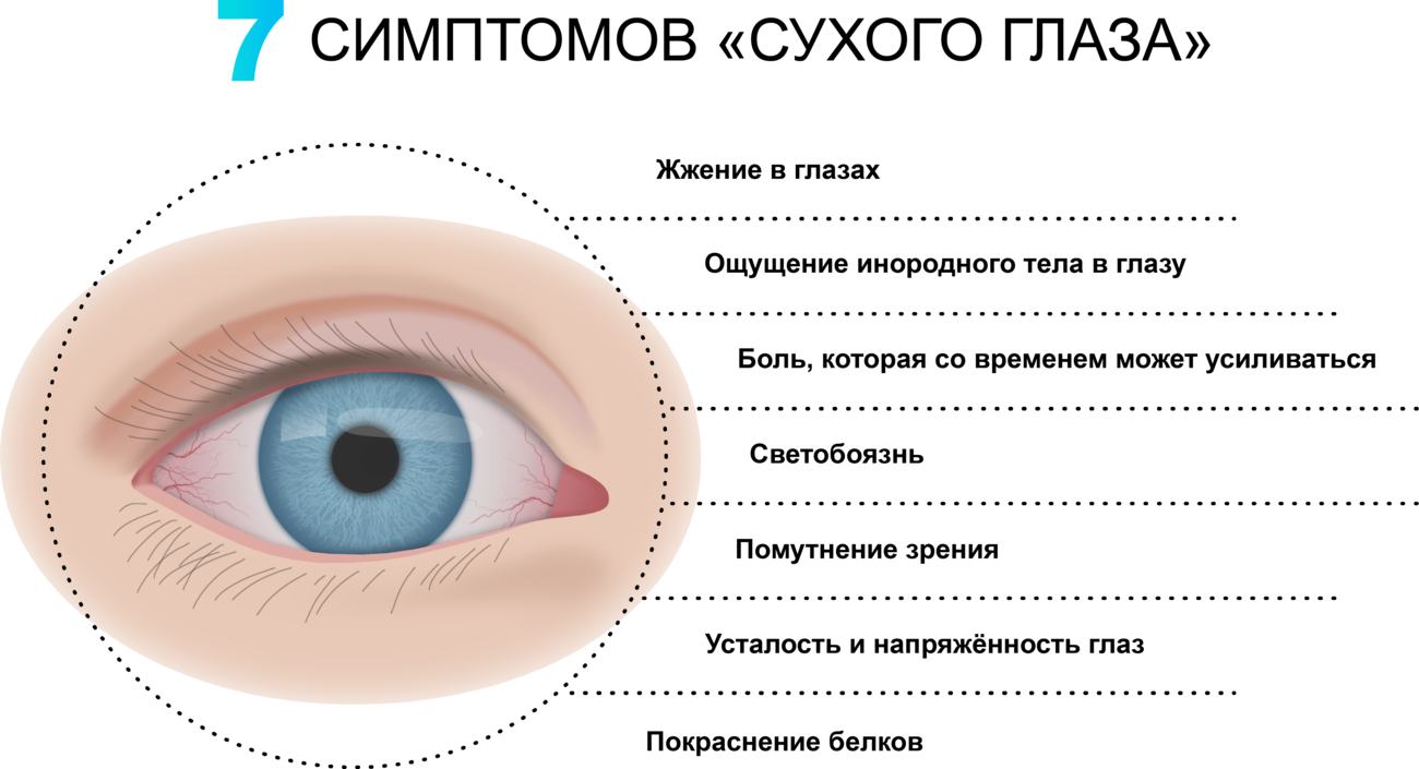 Синдром сухого глаза - лечение и профилактика!