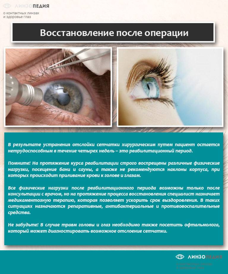 Отслоение сетчатки глаза: операция для восстановления зрения