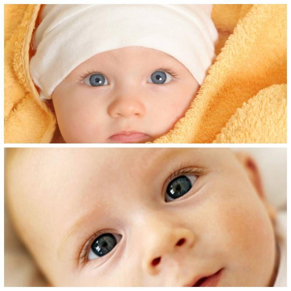 Желтые глаза у новорожденного – что означают желтые пятна на глазном яблоке