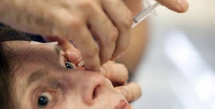 Укол в глаз для сетчатки - показания к интравитреальному введению препаратов как эффективное средство для лечения дистрофии