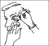 Оказание первой помощи при травмах глаз: основные правила