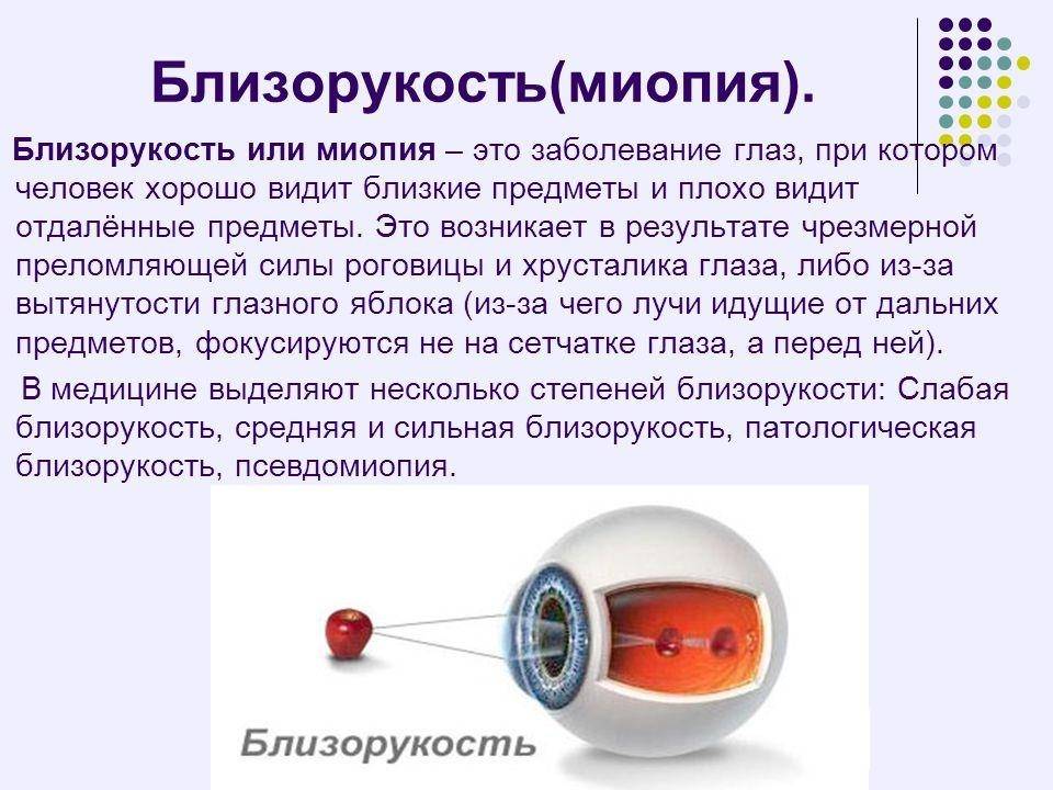 Миопия – что это такое? миопия глаза слабой, средней, высокой степени – как улучшить зрение при близорукости?