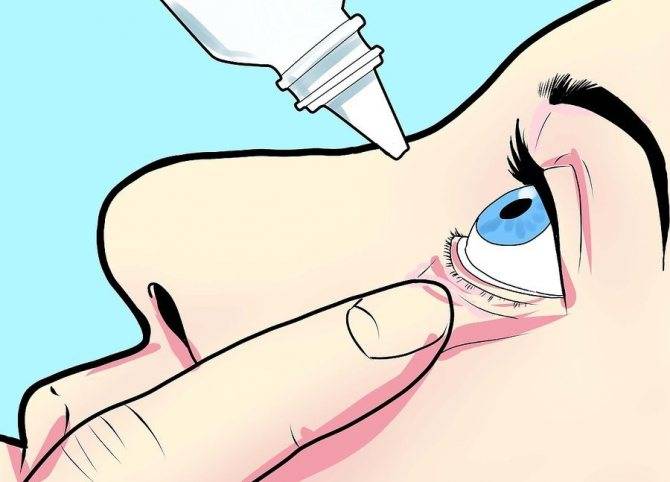 Как правильно закапывать глазные капли ребенку или взрослому - "здоровое око"