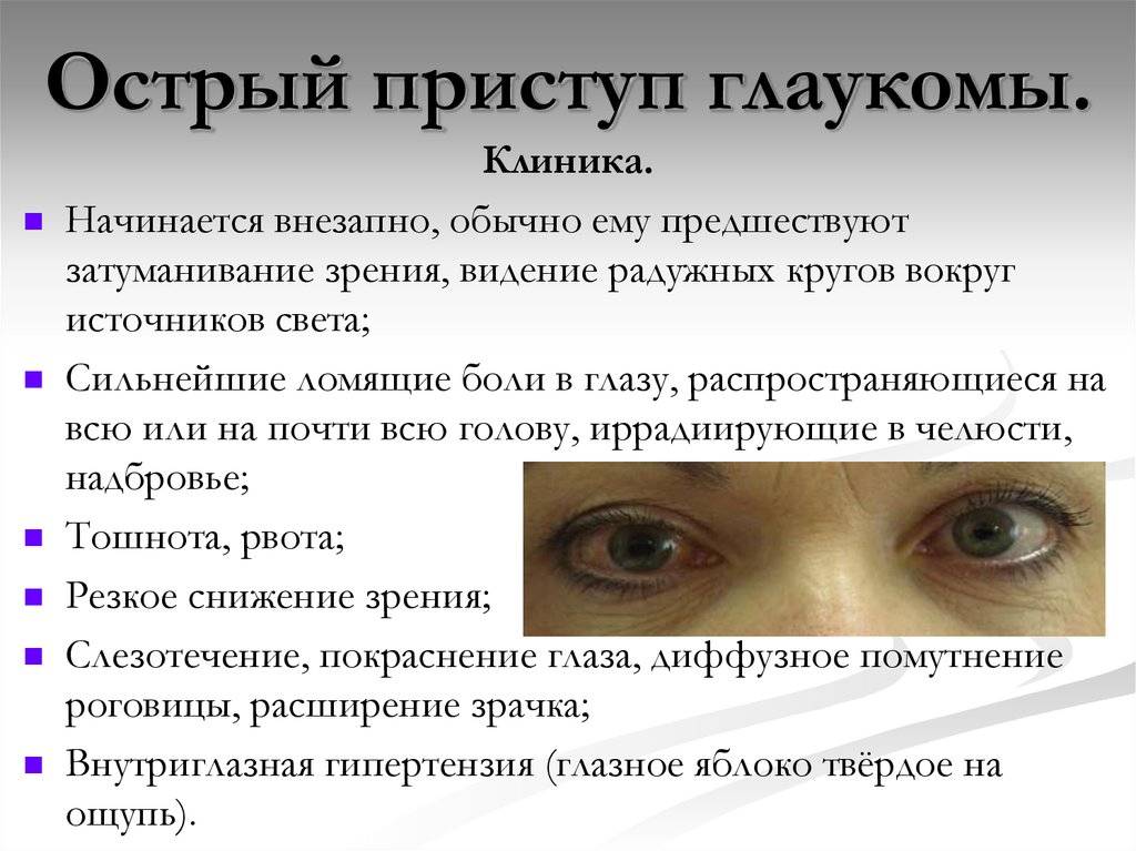 Клиника глаза симптомы
