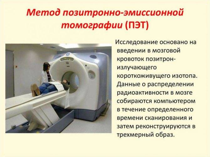 Оптическая когерентная томография глаза: виды окт сетчатки глаза, показания, подготовка, как выполняется