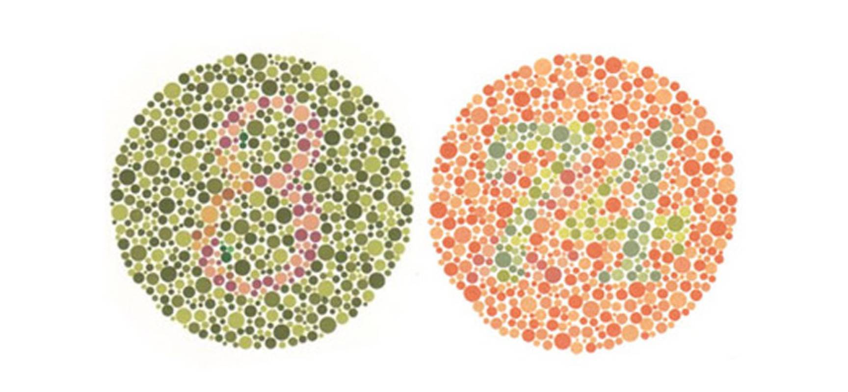 Аномалии цветового зрения: симптомы и лечение цветоаномалии