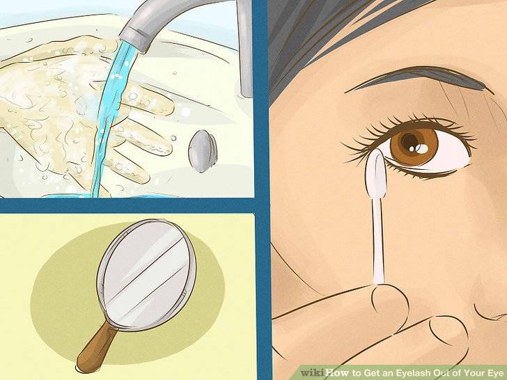 Как вытащить соринку из глаза: 10 шагов