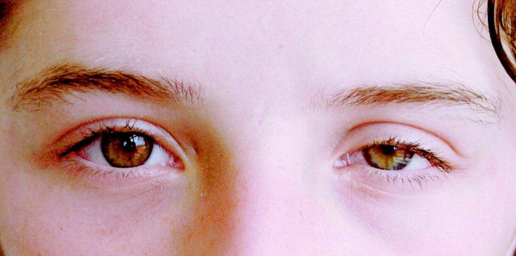 Какие болезни глаз чаще всего встречаются у детей: полный список