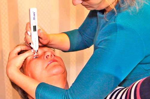 Измерение внутриглазного давления, как измеряют глазное давление в домашних условиях и клинике
