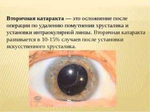 Чем опасна катаракта? последствия отсутствия лечения