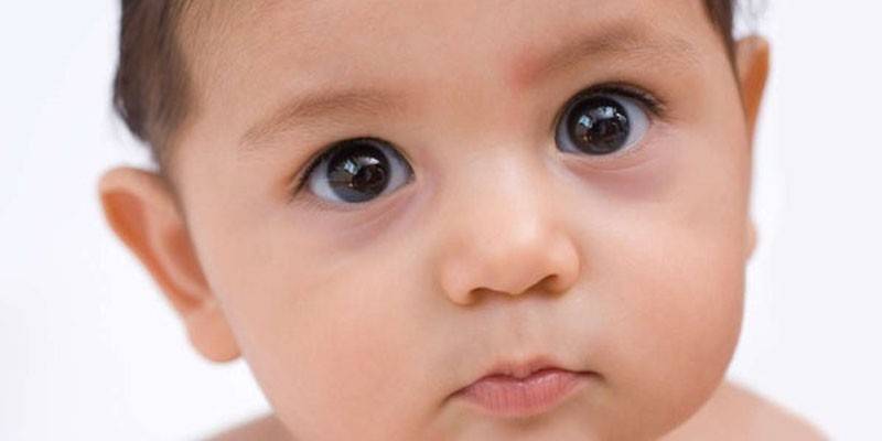 Мешки под глазами у ребенка – стоит ли волноваться?