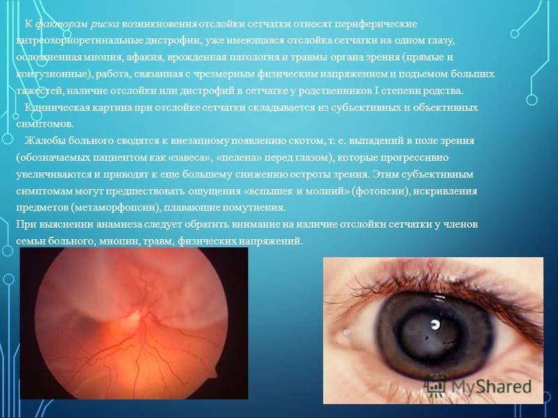 Афакия глаза: что это такое, фото, признаки, причины отсутствия хрусталика, диагностика, лечение (очками, линзами, операцией)