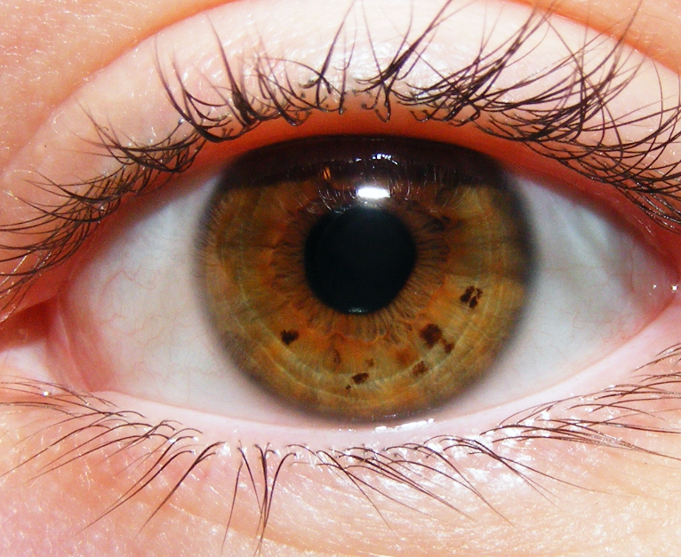 Что означает черная точка на радужке глаза. иридодиагностика - схема радужной оболочки глаза и признаки заболеваний. сигнал от почек
