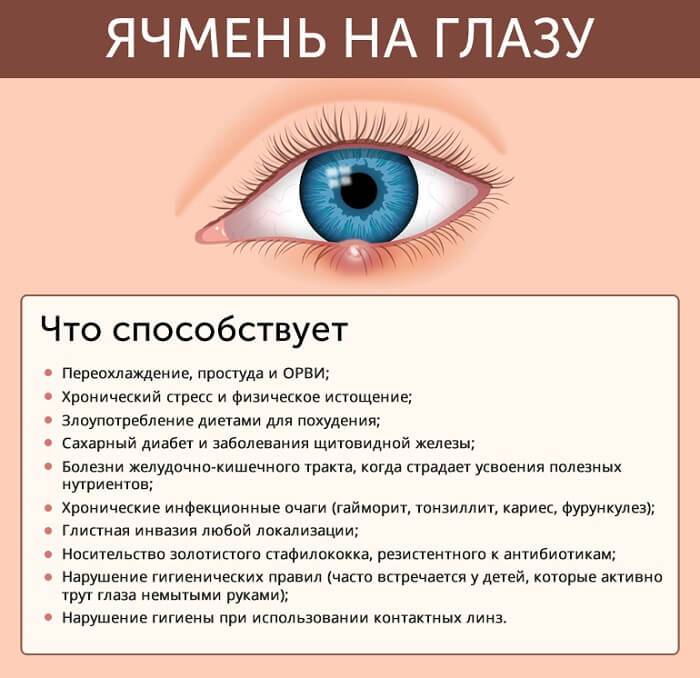 Ячмень на глазу: лечение, признаки, причины появления