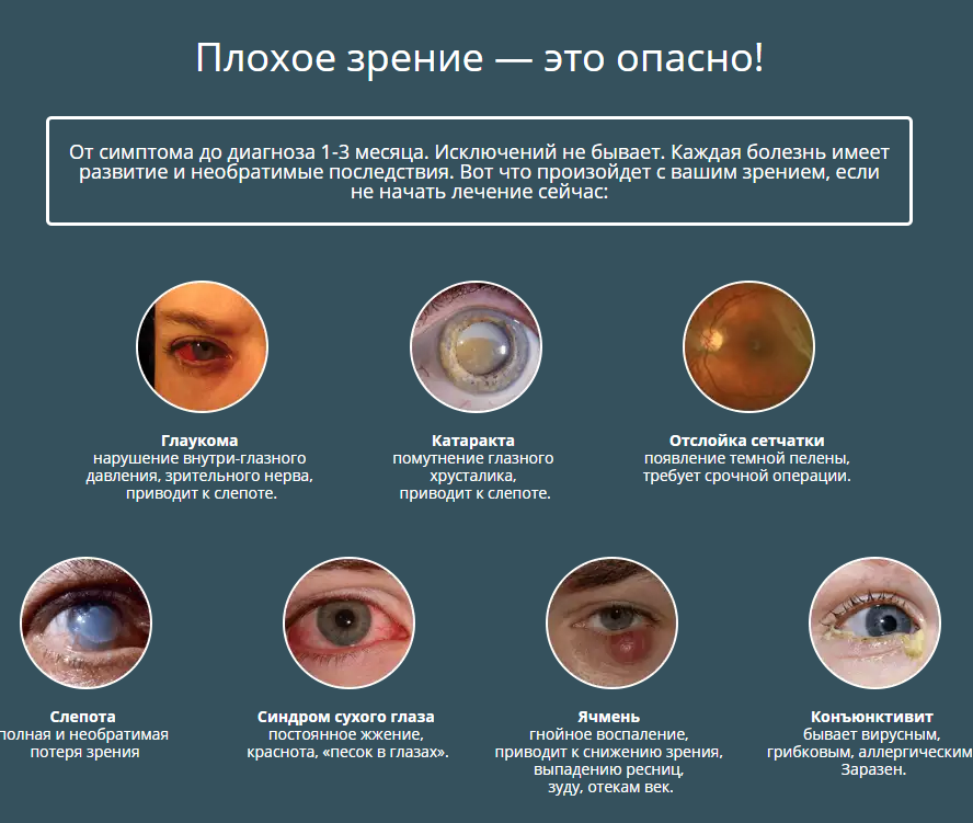 Дефекты зрения - список основных, причины, лечение