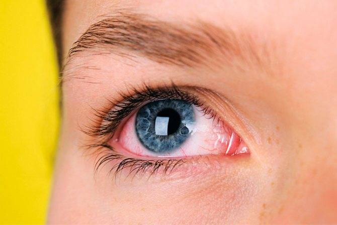 Лучшие глазные капли при слезотечении и от зуда: недорогие и эффективные