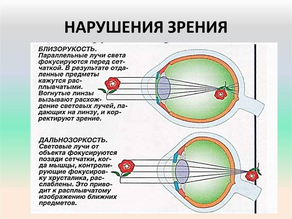 Нарушения зрения: виды нарушений остроты зрения (близорукость и дальнозоркость) | что делать, если один глаз стал хуже видеть | ослабление и ухудшение зрения