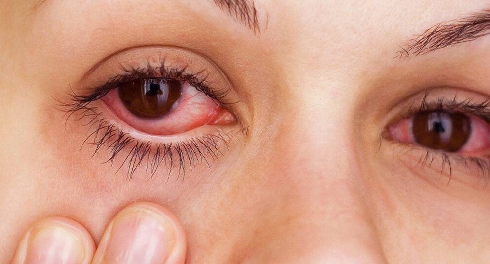 Список эффективных капель от слезоточивости глаз