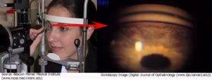 Диагностика глаукомы: методы обследования для раннего выявления заболевания, как делают измерение вгд