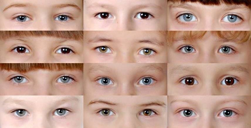 Когда меняется цвет глаз у новорожденных и почему это происходит