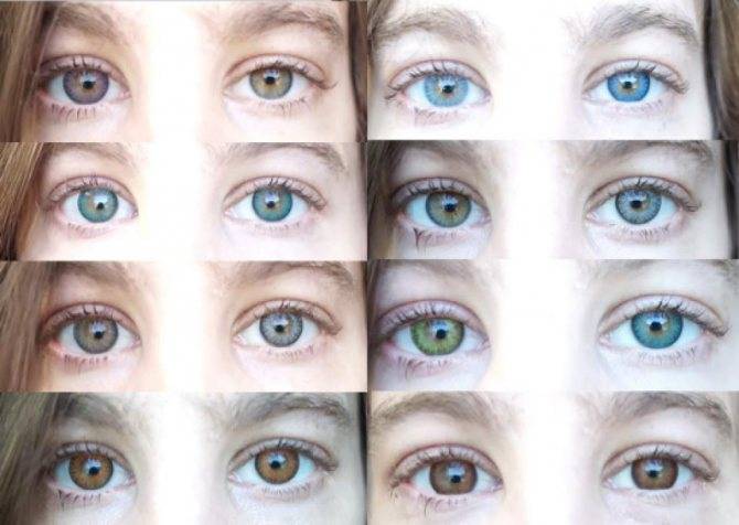Не вредны ли цветные контактные линзы для глаз? особенности использования цветных линз