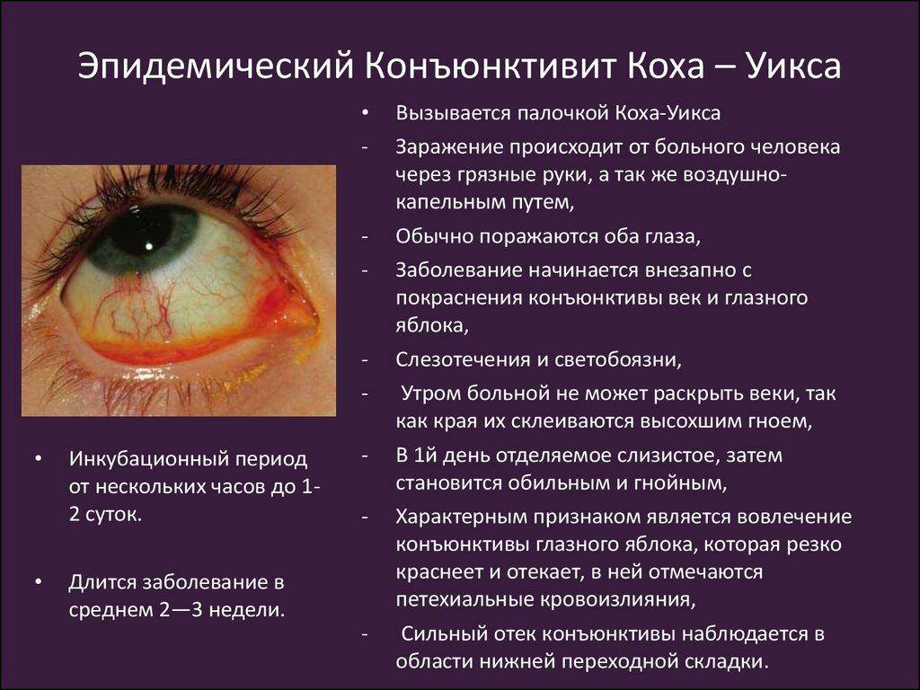 Заболевания глаз клиника