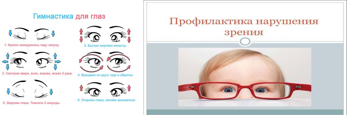 Профилактика нарушения зрения. причины нарушения зрения